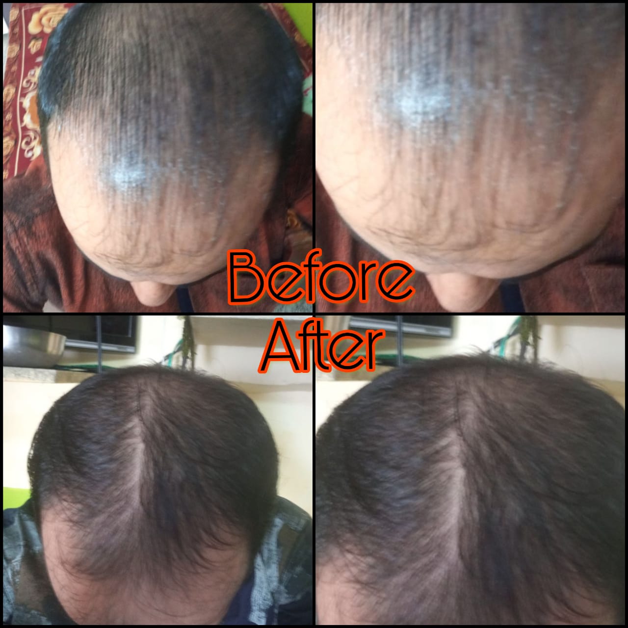 Hair Oil