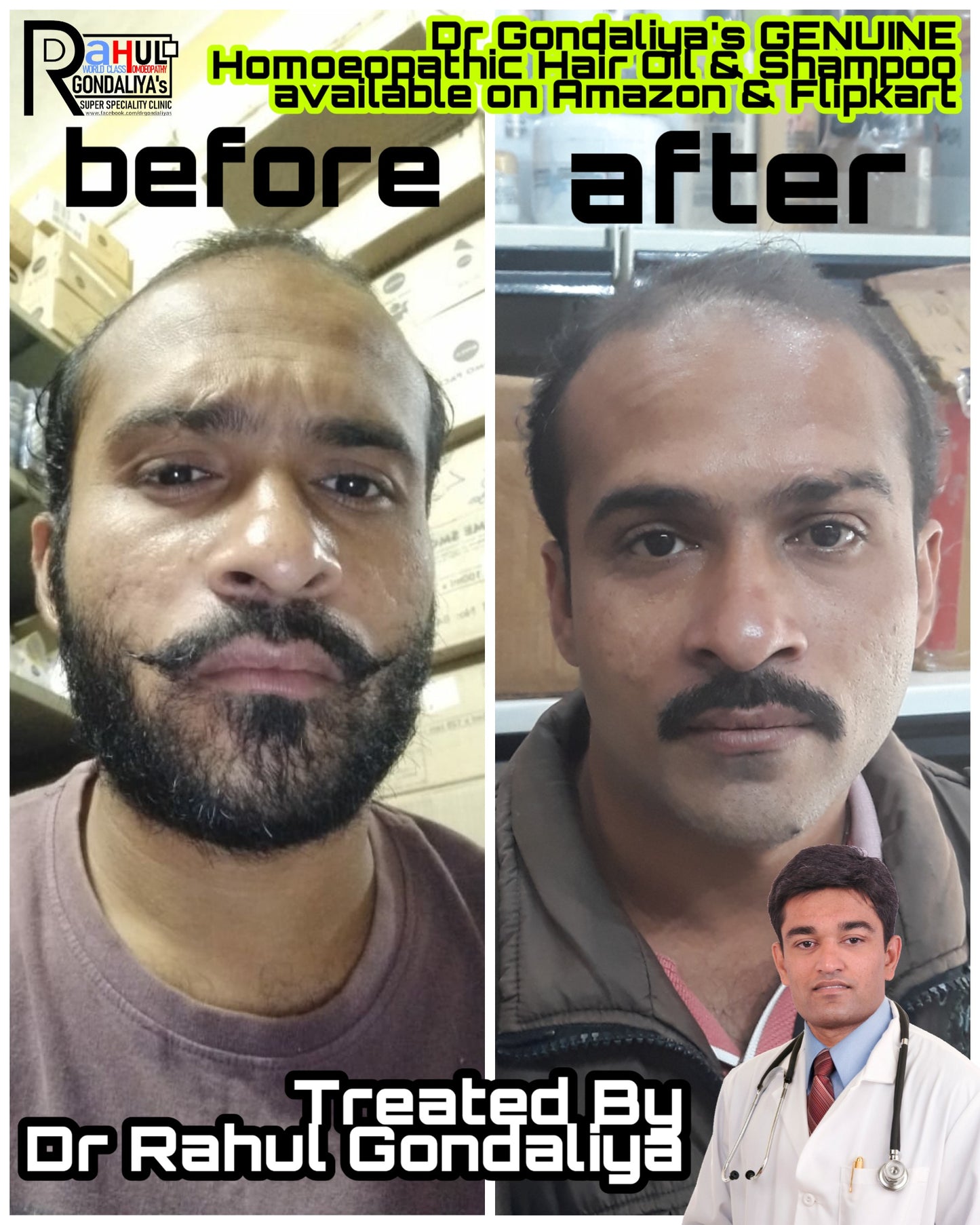 Hair Oil