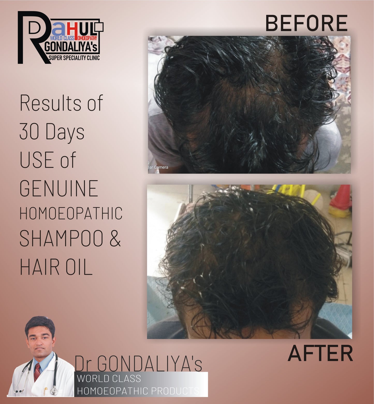 Hair Oil