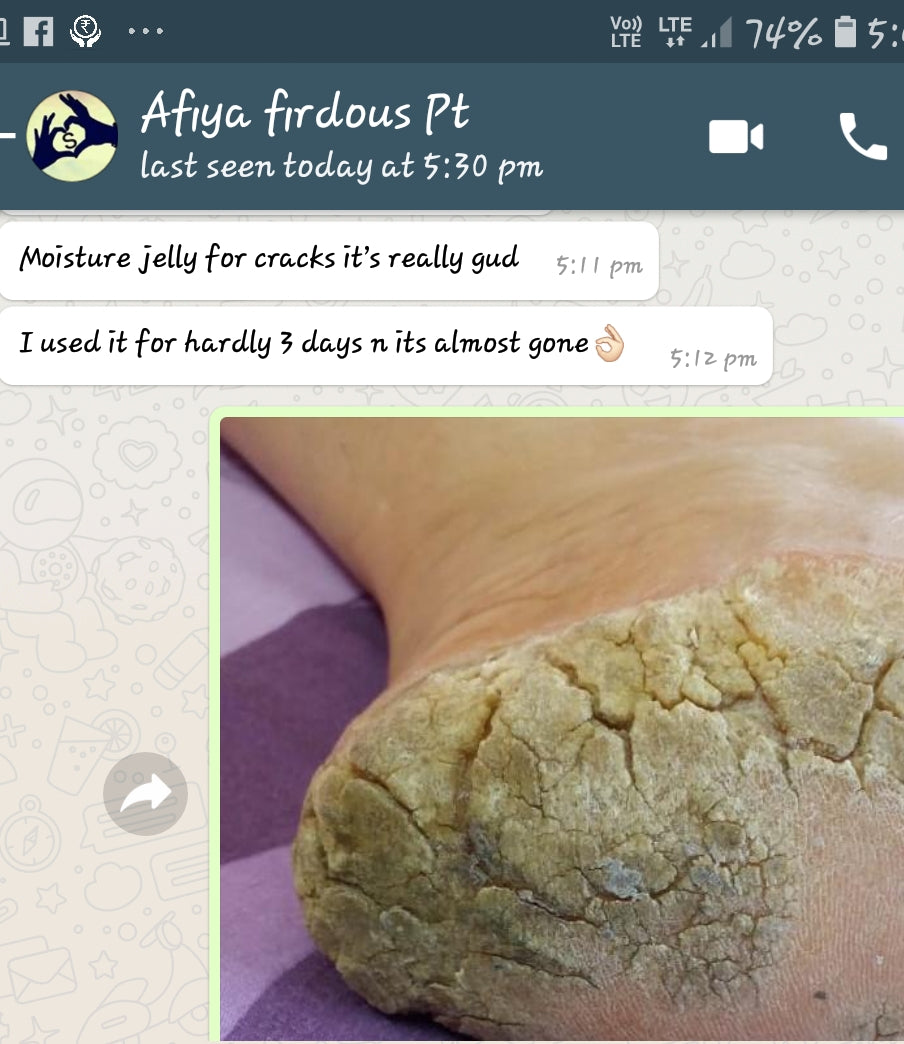 Dr GONDALIYA’s™ Homoeopathic Moisture Jelly - Foot Crack Cream