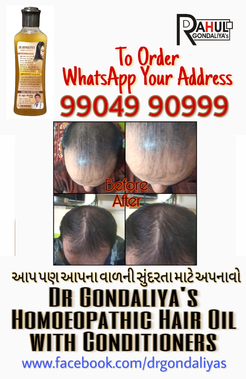 Dr GONDALIYA’s™ Homoeopathic Non Sticky Hair Oil