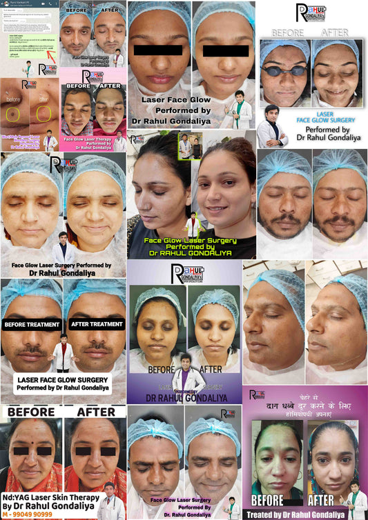 Face Care