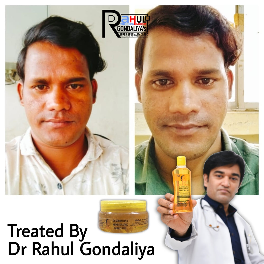 Dr GONDALIYA’s™ Homoeopathic Brightening Fairness Gel