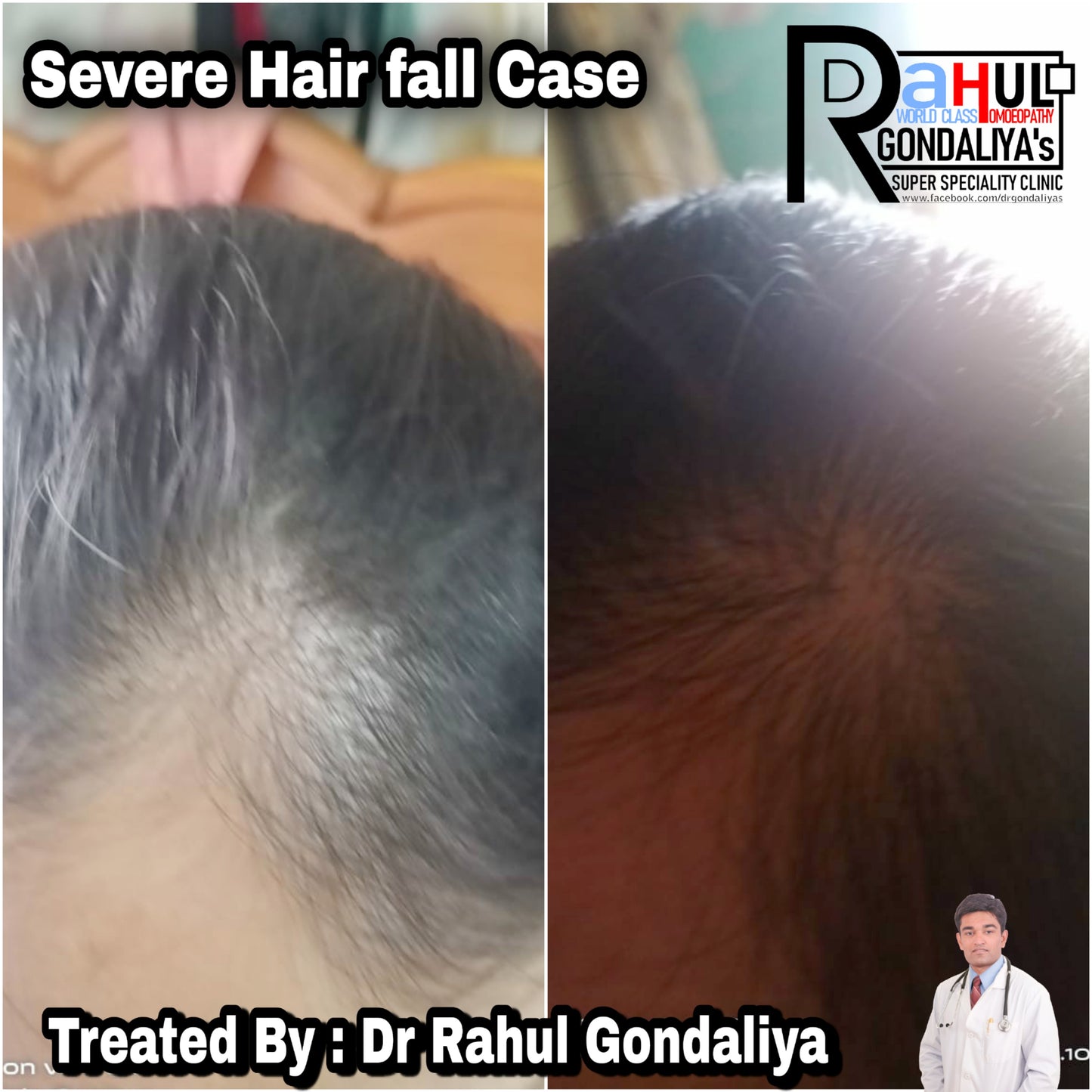 Dr GONDALIYA’s™ Homoeopathic Super Soft Shampoo