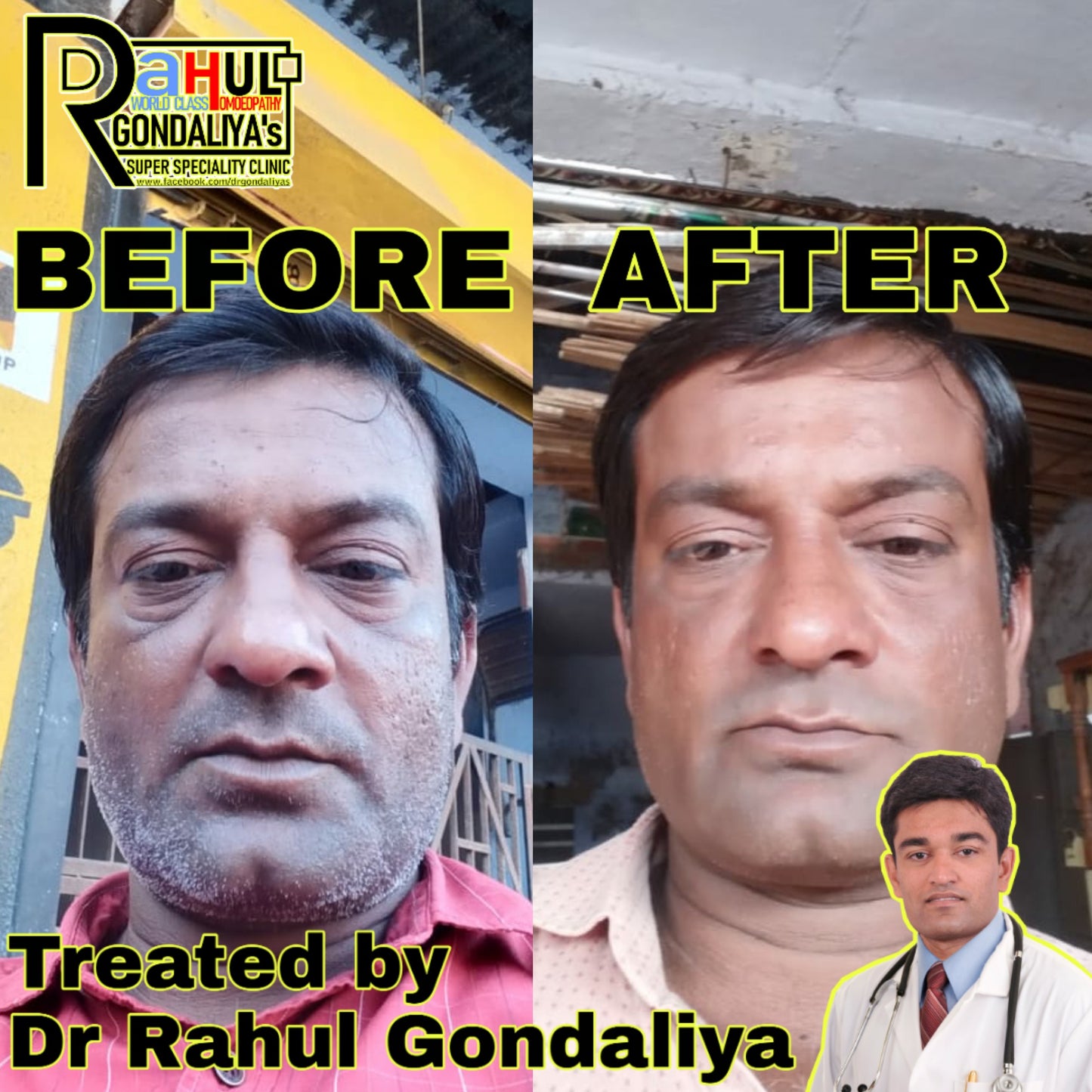 Dr GONDALIYA’s™ Homoeopathic Glowing Face Wash