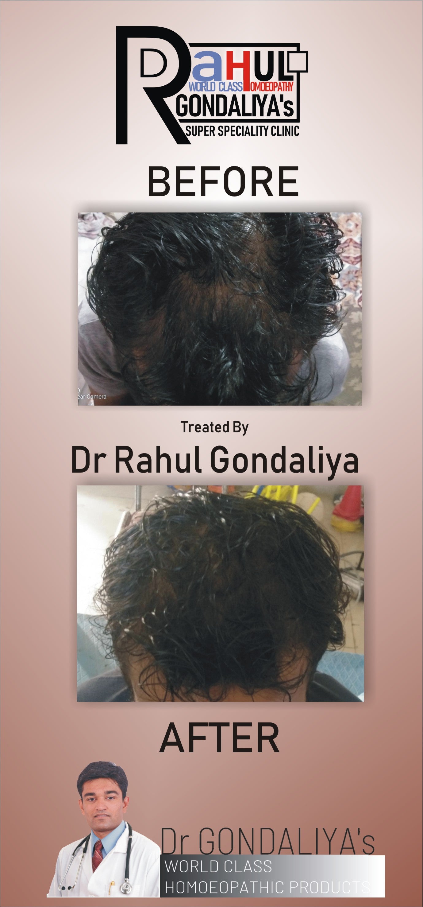 Dr GONDALIYA’s™ Homoeopathic Non Sticky Hair Oil